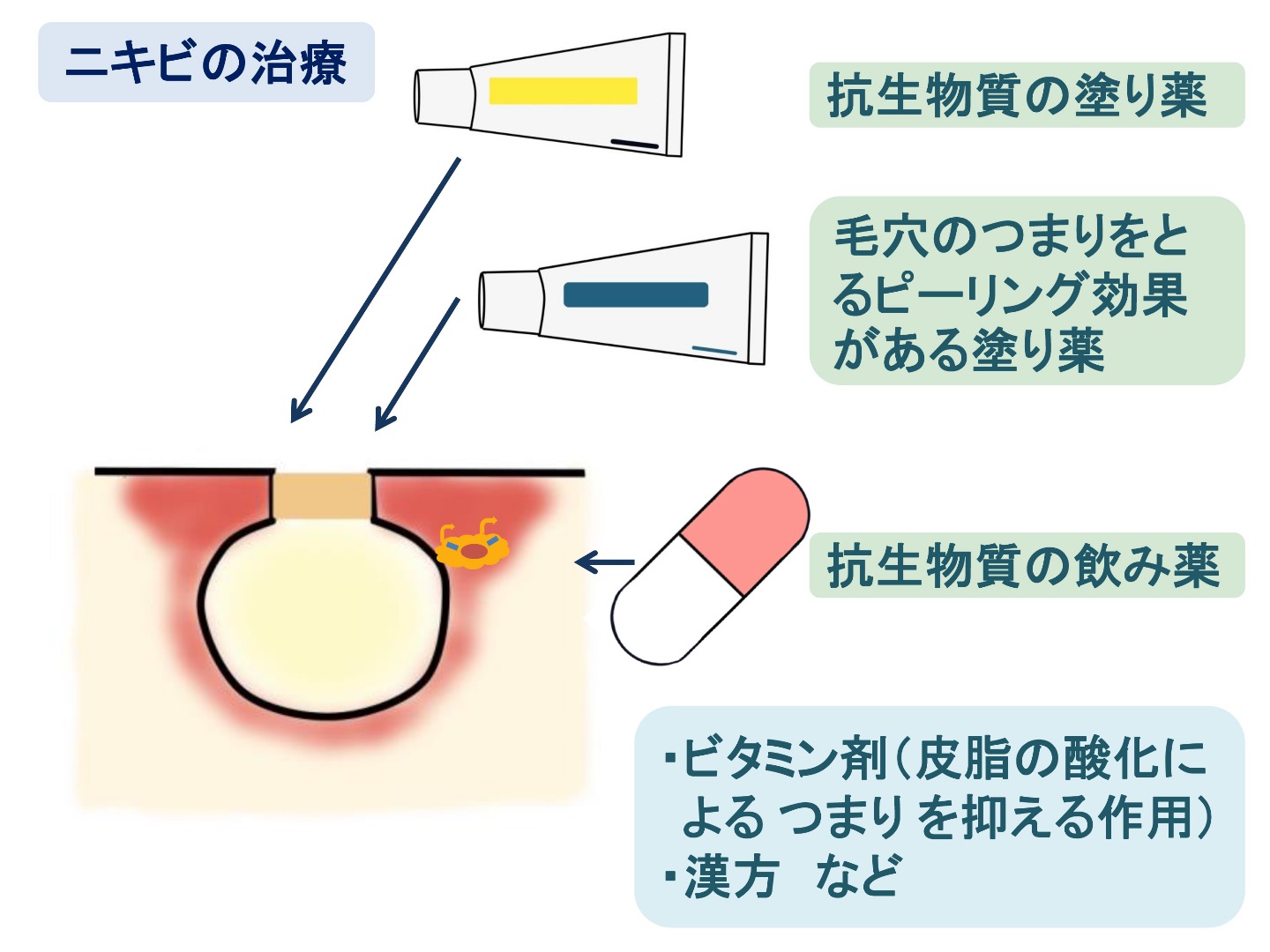 飲み 科 ニキビ 薬 皮膚